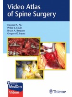 Video Atlas of Spine Surgery