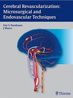 Cerebral Revascularization : Microsurgical and Endovascular Techniques