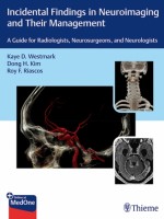 Incidental Findings in Neuroimaging and Their Management