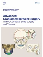 Advanced Craniomaxillofacial Surgery: Tumor, Corrective Bone Surgery, and Trauma