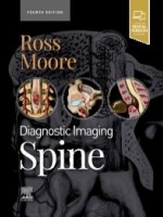 Diagnostic Imaging: Spine, 4e