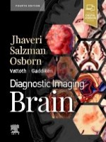 Diagnostic Imaging: Brain, 4e