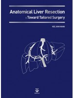 Anatomical Liver Resection : Toward Tailored Surgery(동영상CD포함)
