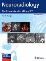 Neuroradiology The Essentials with MR and CT, 2e