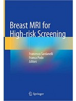 Breast MRI for High-risk Screening