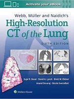 High-Resolution CT of the Lung, 6e