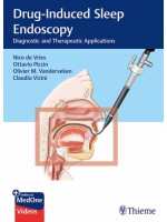 Drug-Induced Sleep Endoscopy Diagnostic and Therapeutic Applications