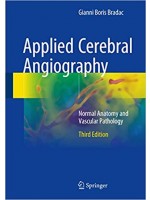 Applied Cerebral Angiography : Normal Anatomy and Vascular Pathology, 3e