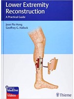 Lower Extremity Reconstruction A Practical Guide