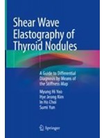 Shear Wave Elastography of Thyroid Nodules