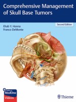 Comprehensive Management of Skull Base Tumors, 2e