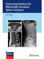 Instrumentation for Minimally Invasive Spine Surgery