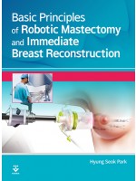 Basic Principles of Robotic Mastectomy and Immediate Breast Reconstruction