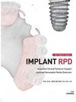 Dr. Huh`s Q&A IMPLANT RPD