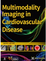 Multimodality Imaging in Cardiovascular Disease