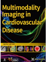 Multimodality Imaging in Cardiovascular Disease