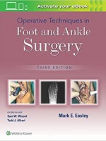 Operative Techniques in Foot and Ankle Surgery, 3e