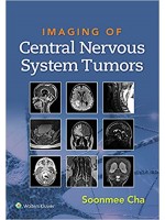 Imaging of Central Nervous System Tumors First Edition