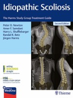 Idiopathic Scoliosis, 2e