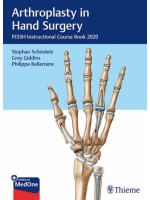 Arthroplasty in Hand Surgery