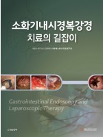 소화기내시경복강경 치료의 길잡이