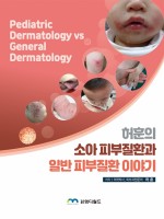 허훈의 소아 피부질환과 일반 피부질환 이야기(Pediatric Dermatology vs General Dermatology)