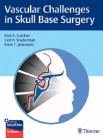 Vascular Challenges in Skull Base Surgery