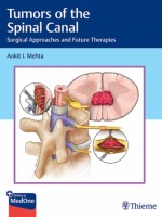 Tumors of the Spinal Canal: Surgical Approaches and Future Therapies