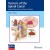 Tumors of the Spinal Canal: Surgical Approaches and Future Therapies