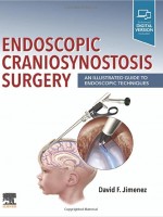 Endoscopic Craniosynostosis Surgery: An Illustrated Guide to Endoscopic Techniques 1st