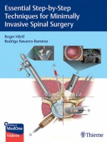 Essential Step-by-Step Techniques for Minimally Invasive Spinal Surgery