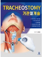 기관절개술