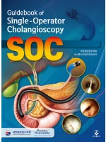 Guidebook of Single-Operator Cholangioscopy