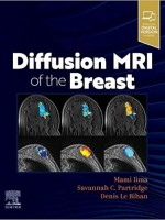Diffusion MRI of the Breast