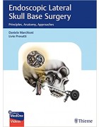 Endoscopic Lateral Skull Base Surgery