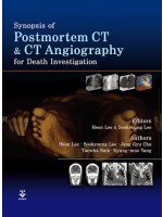 Synopsis of Postmortem CT and CT Angiography for Death Investigation 신간
