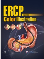 ERCP Color Illustration, 2e
