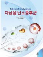 다낭성 난소증후군 [2020 대한민국학술원 우수학술도서 선정!]