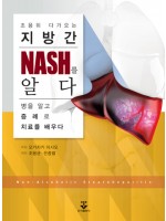 조용히 다가오는 지방간 – NASH를 알다