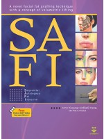 SAFI-English ver. (Sequential Autologous Fat Injection)