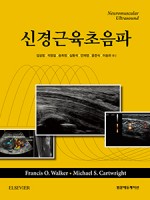 신경근육초음파 (Neuromuscular Ultrasound)