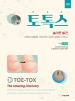 토톡스 TOE-TOX -놀라운 발견, 내향성 발톱을 치료하면 다양한 질병이 낫는다.