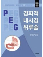 경피적 내시경 위루술 (PERCUTANEOUS ENDOSCOPIC GASTROSTOMY)