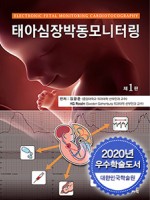 태아심장박동모니터링