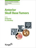 Anterior Skull Base Tumors (Advances in Oto-Rhino-Laryngology, Vol. 84)