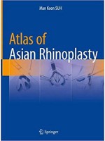 Atlas of Asian Rhinoplasty