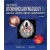 Ballenger's Otorhinolaryngology: Head and Neck Surgery 18e