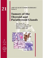 Tumors of the Thyroid and Parathyroid Glands