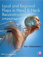 Local and Regional Flaps in Head & Neck Reconstruction: A Practical Approa
