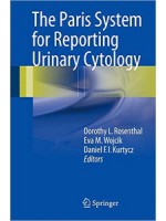 The Paris System for Reporting Urinary Cytology